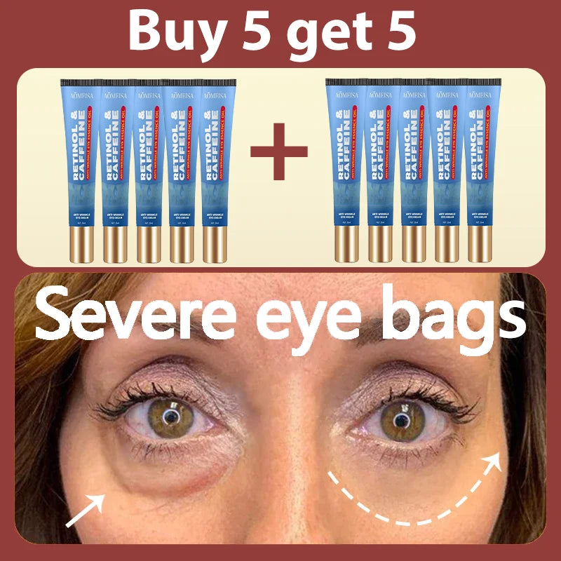 Daily eye cream, say goodbye to dark circles and eye troubles.