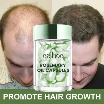 Hair Growth Essential Oil Rosemary Hair Serum Capsule Oil Anti Hair loss Baldness Repair Damaged Scalp Treatment For Women Men