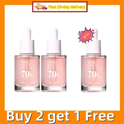 Niacinamide Whitening Freckles Serum Removal Melasma Dark Spots Lighten Melanin Pigmentation Brightening Anti-Aging Skin Care