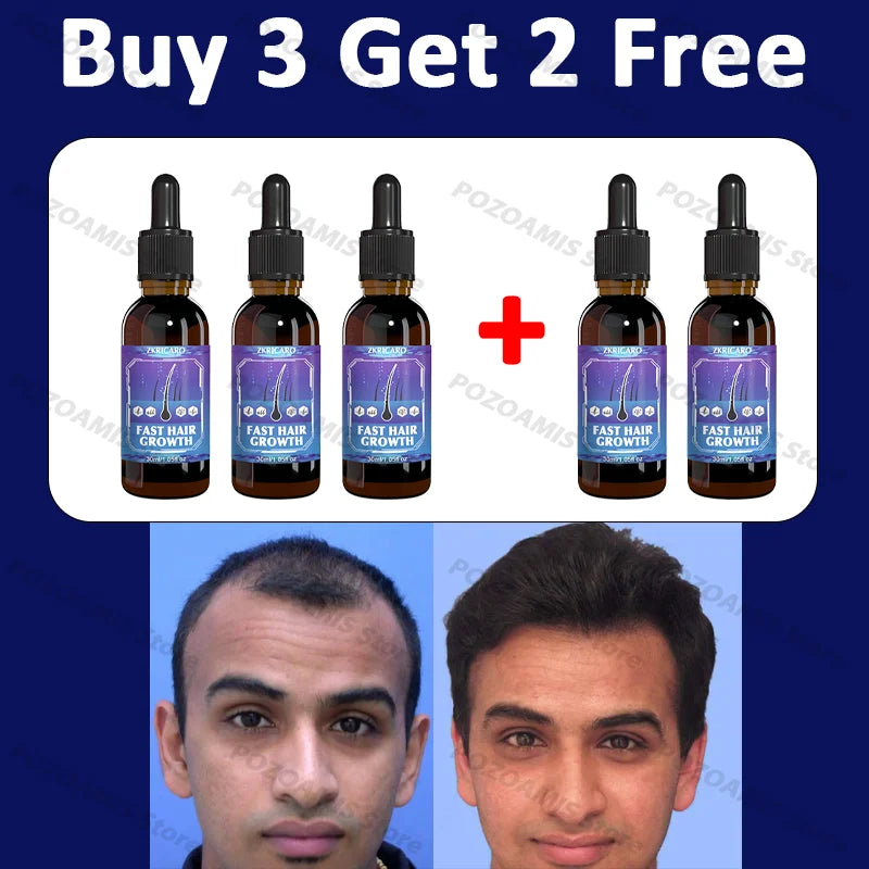 99% repurchase, more and more hair, say goodbye to baldness, hot selling product