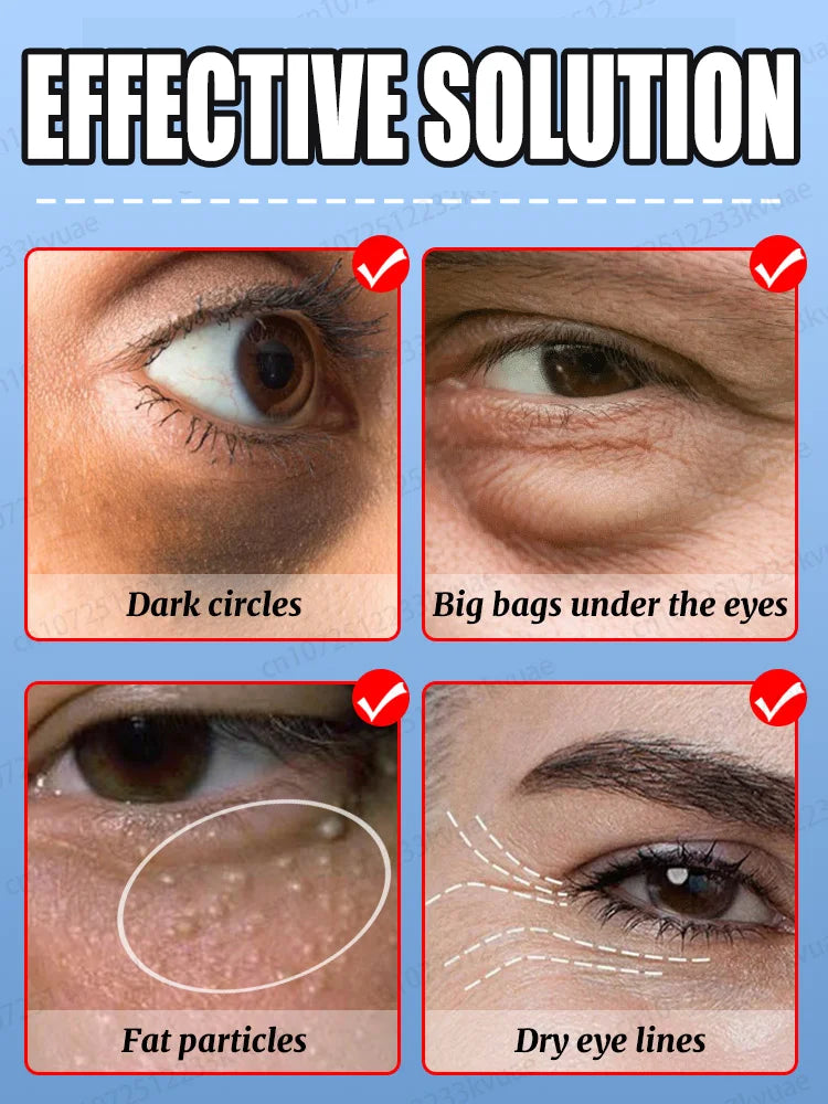 Daily eye cream, say goodbye to dark circles and eye troubles.