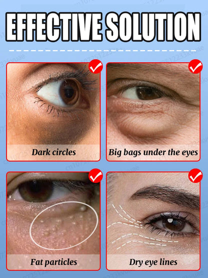 Daily eye cream, say goodbye to dark circles and eye troubles.