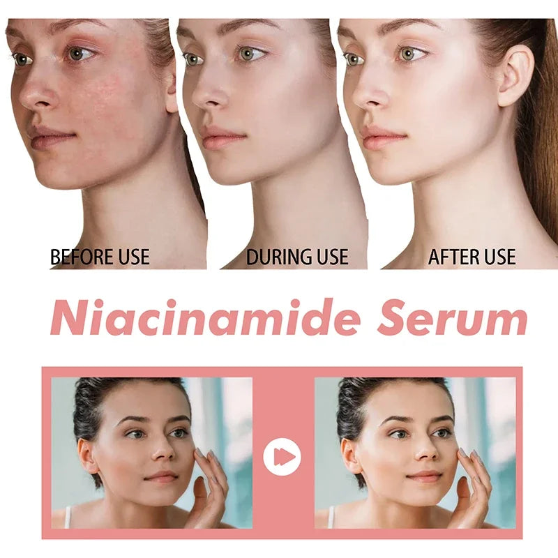30ml Peach 70% Niacinamide Serum Moisturizing Prevent Dryness Facial Essential Oil Increasing Elasticity Smooth Soften Skin Care