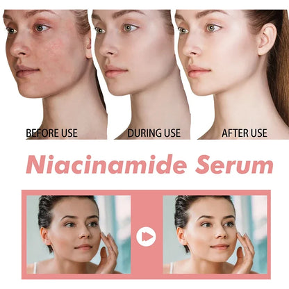 30ml Peach 70% Niacinamide Serum Moisturizing Prevent Dryness Facial Essential Oil Increasing Elasticity Smooth Soften Skin Care