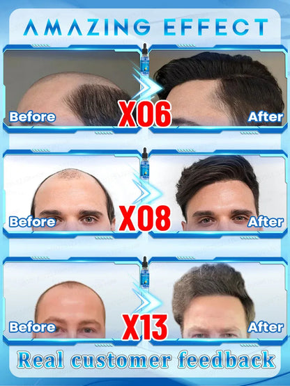 Use natural herbs to make your hair thicker thicker and stronger