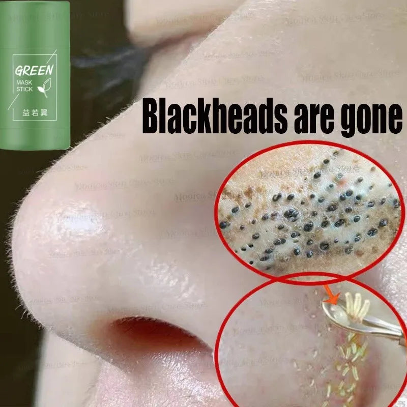Original Green Tea Deep Remove Blackheads Acne Mud Mask Stick Shrink Pores Dispel Acne Cream Treat Pimple Korean Clean Skin Care