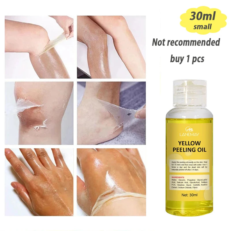 Strong Yellow Peeling Oil Bleach Dark Skin Whiten Lotion Lighten Body Elbow Knee Hand Exfoliate Dead Skin Nourish Even Skin Tone