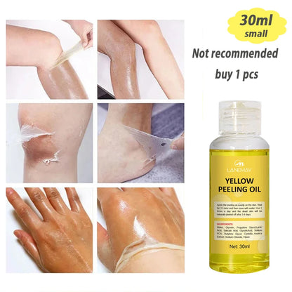 Strong Yellow Peeling Oil Bleach Dark Skin Whiten Lotion Lighten Body Elbow Knee Hand Exfoliate Dead Skin Nourish Even Skin Tone