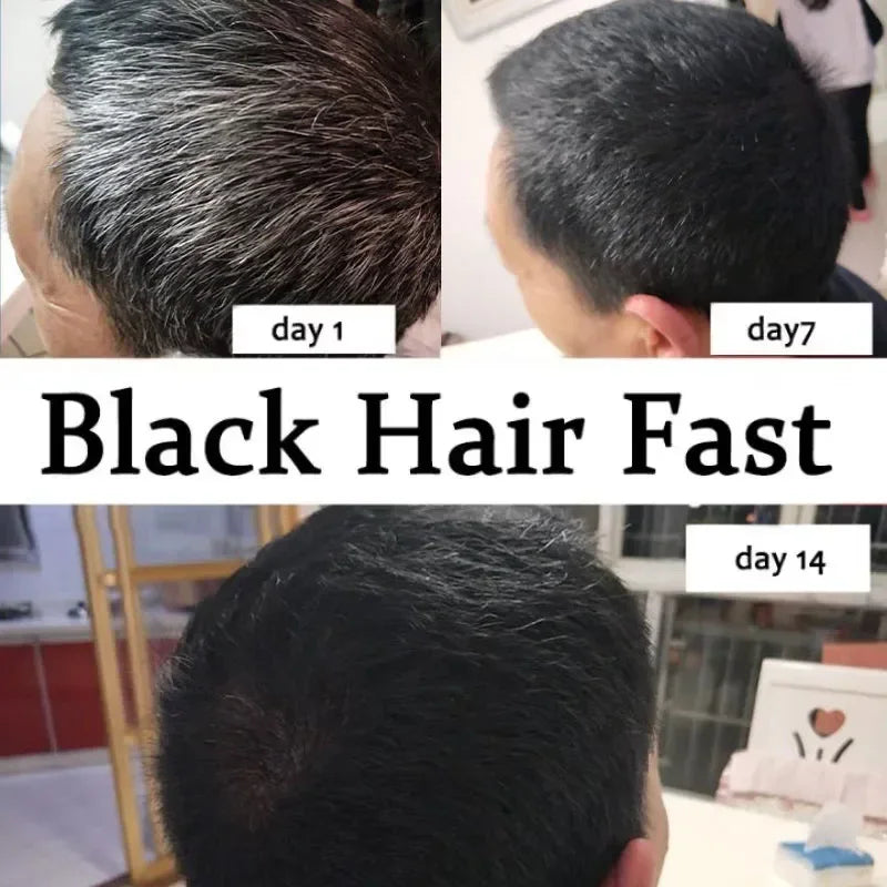 Gray White Hair Treatment Serum Cover White To Black Natural Color Repair Spray Anti Loss Hair Restore Healthy Hair Care