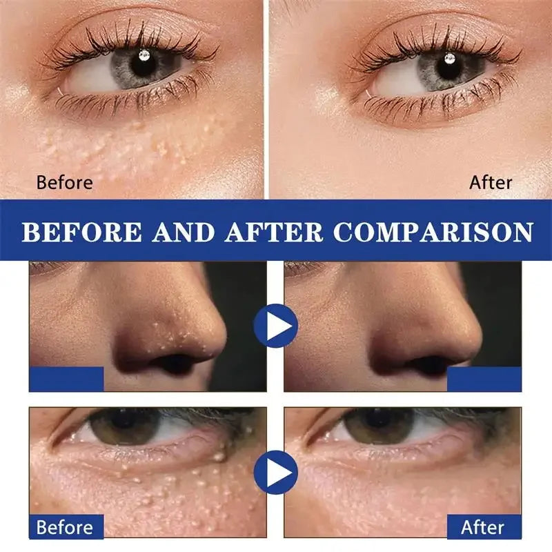 Fat Granules Removal Eye Cream Stick Anti-Puffiness Anti Inflammatory Eye Skin Care Reduce Dark Circles Repair Barrier Products