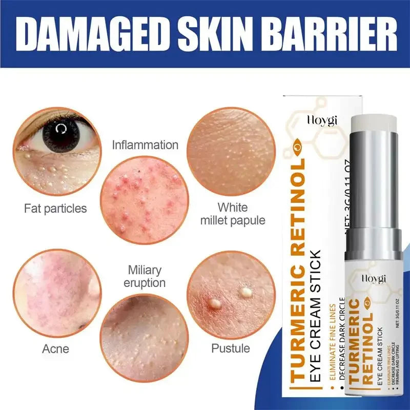 Fat Granules Removal Eye Cream Stick Anti-Puffiness Anti Inflammatory Eye Skin Care Reduce Dark Circles Repair Barrier Products