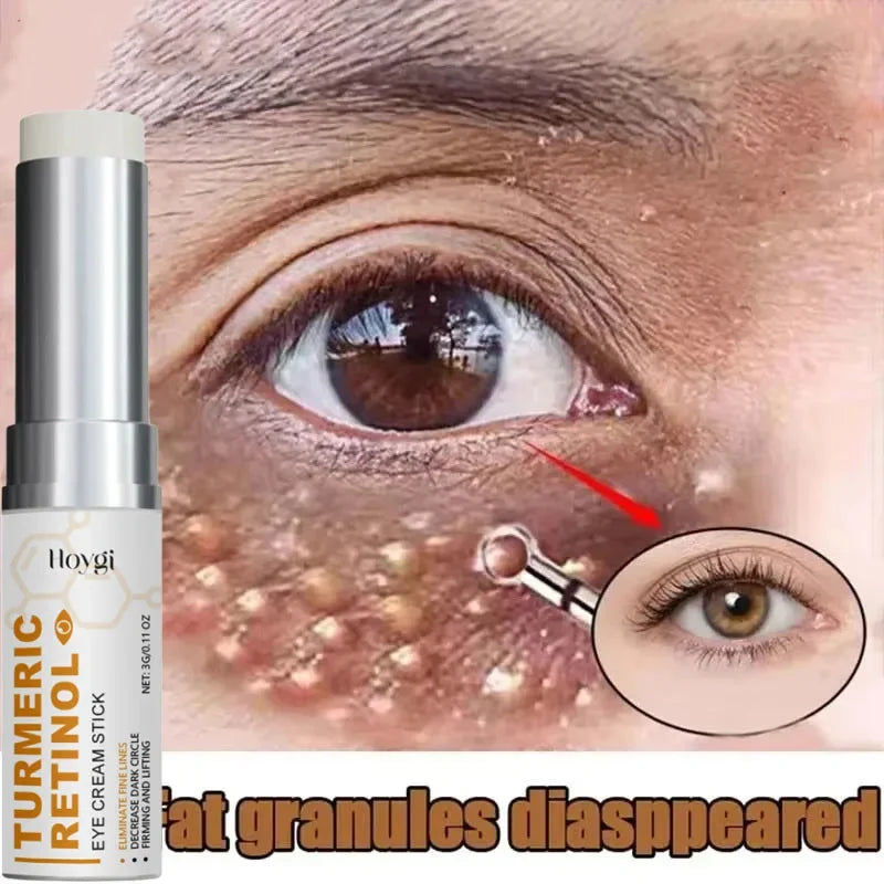 Fat Granules Removal Eye Cream Stick Anti-Puffiness Anti Inflammatory Eye Skin Care Reduce Dark Circles Repair Barrier Products