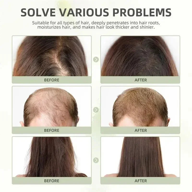 Hair Growth Essential Oil Rosemary Hair Serum Capsule Oil Anti Hair loss Baldness Repair Damaged Scalp Treatment For Women Men