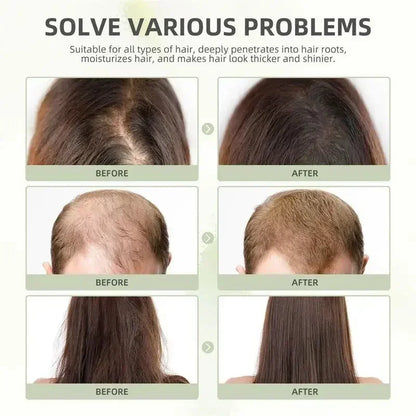 Hair Growth Essential Oil Rosemary Hair Serum Capsule Oil Anti Hair loss Baldness Repair Damaged Scalp Treatment For Women Men