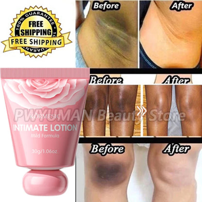 Whitening Cream Private Parts Underarm Bleaching Lotion Whiten Butt Knee Brighten Inner Thigh Intimate Parts Dark Remove Melanin
