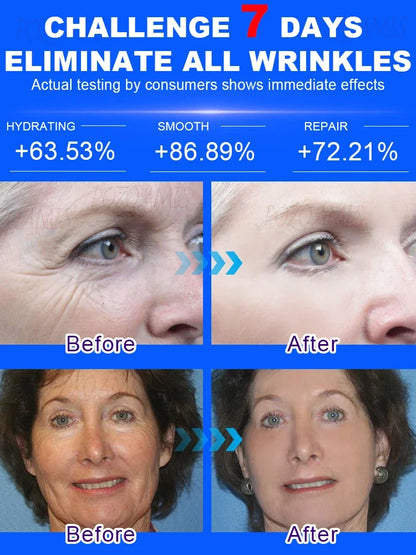 Wrinkles disappear, the first choice for beauty lovers