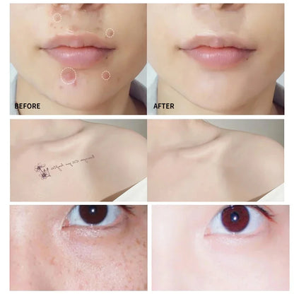 Waterproof Full Coverage Concealer for Tattoos Scars Acne Marks Dark Circles Natural Finish Foundation For All Skin Tones Makeup