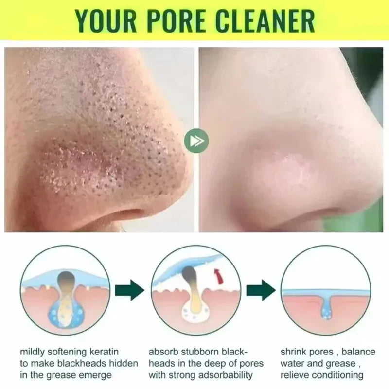 Facial Remove Blackhead Rice Solid Mask Acne Blemish Black Dots Clean Face Shrink Pores Stick Cream Brighten Korean Skincare New