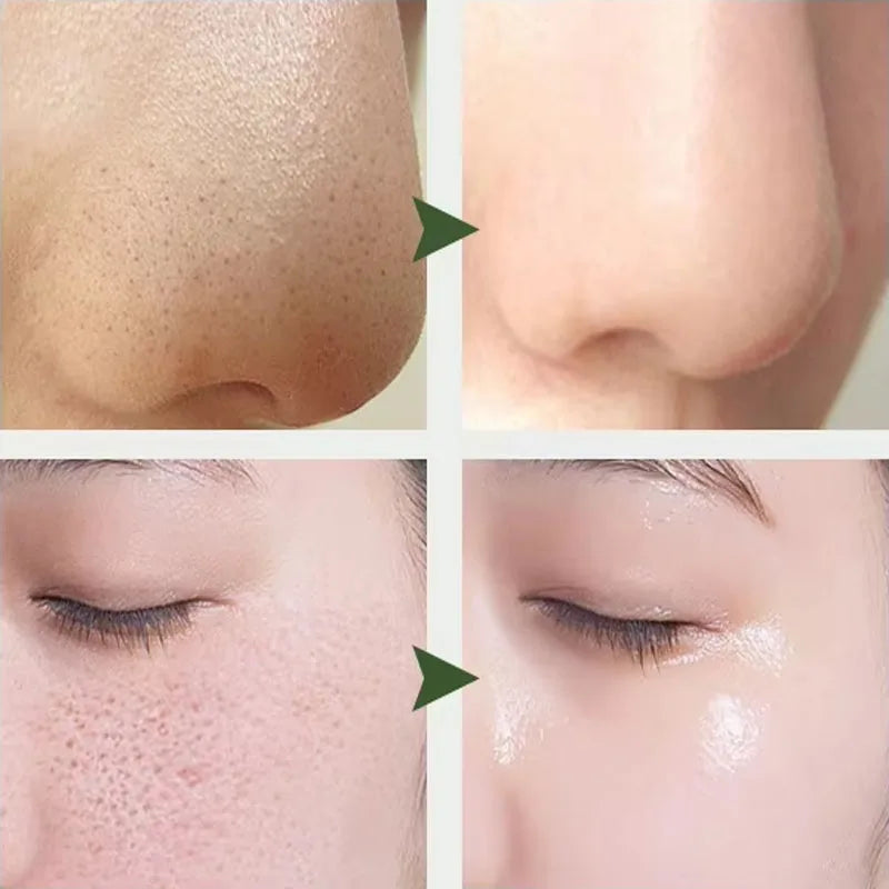 10% Lactic Acid HA Serum Face Peeling Brighten Solution Shrinking Pore Skin Care Tightening Facial Pore Minimizing Ordinary 30ML