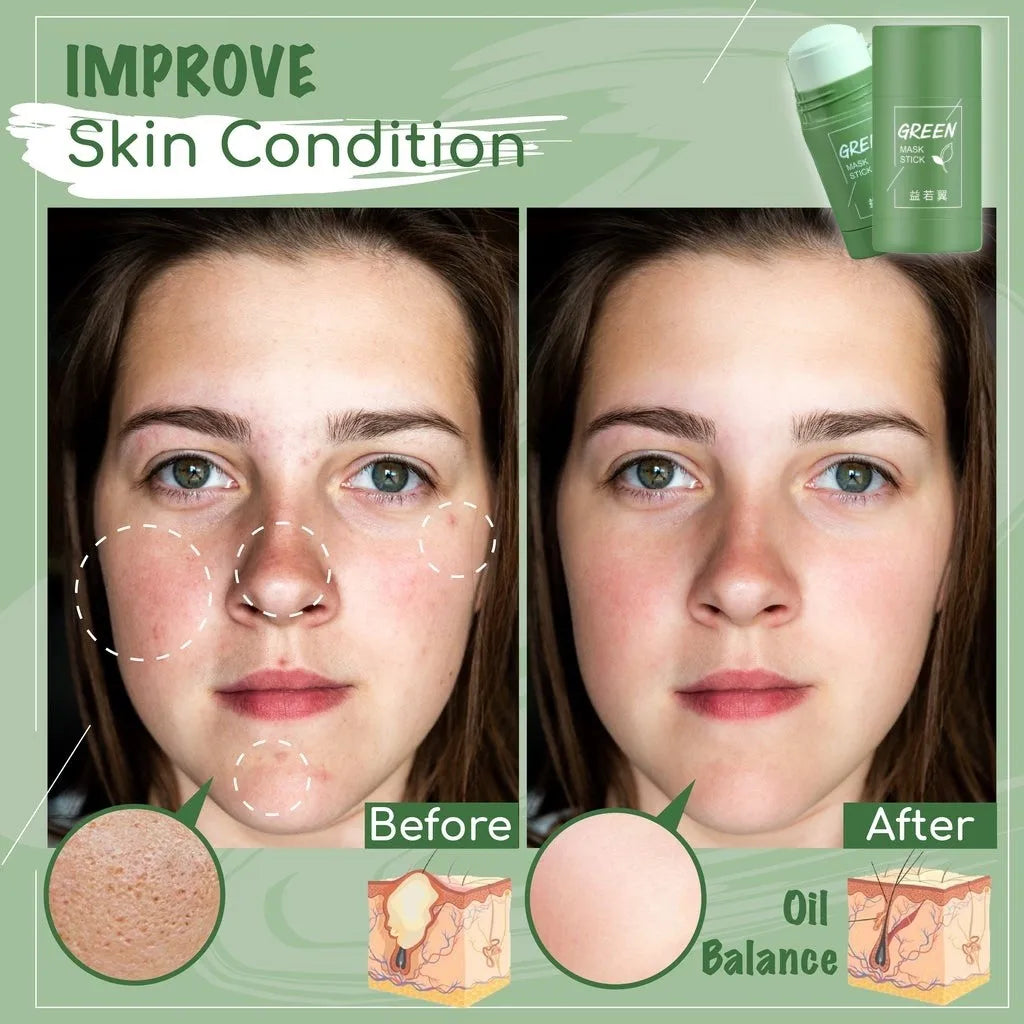 Original Green Tea Deep Remove Blackheads Acne Mud Mask Stick Shrink Pores Dispel Acne Cream Treat Pimple Korean Clean Skin Care