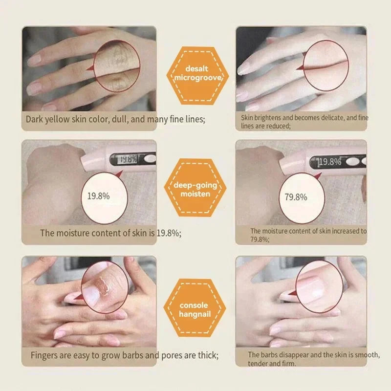 Kojic Acid Whiten Hand Cream,Moisturizing Nourishing Niacinamide Hyaluronic Acid Tender Hand Lotion,Foot Skin Care Products