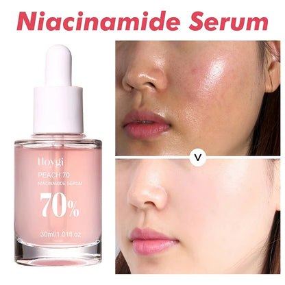 30ml Peach 70% Niacinamide Serum Moisturizing Prevent Dryness Facial Essential Oil Increasing Elasticity Smooth Soften Skin Care