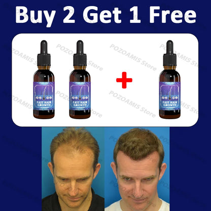 99% repurchase, more and more hair, say goodbye to baldness, hot selling product