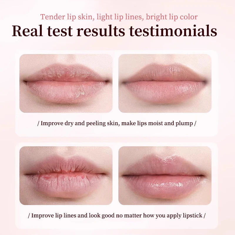 Lip Balm Remove Dark Spots Pigment Fast Lighten Pink Lips Cream