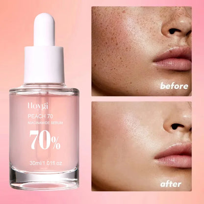 30ml Peach 70% Niacinamide Serum Moisturizing Prevent Dryness Facial Essential Oil Increasing Elasticity Smooth Soften Skin Care