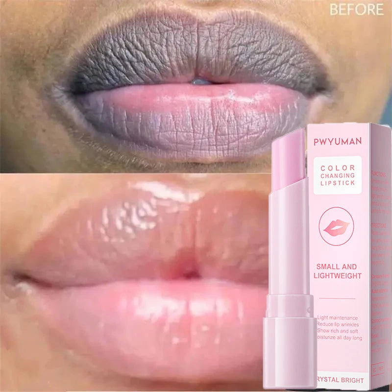 Lip Balm Remove Dark Spots Pigment Fast Lighten Pink Lips Cream
