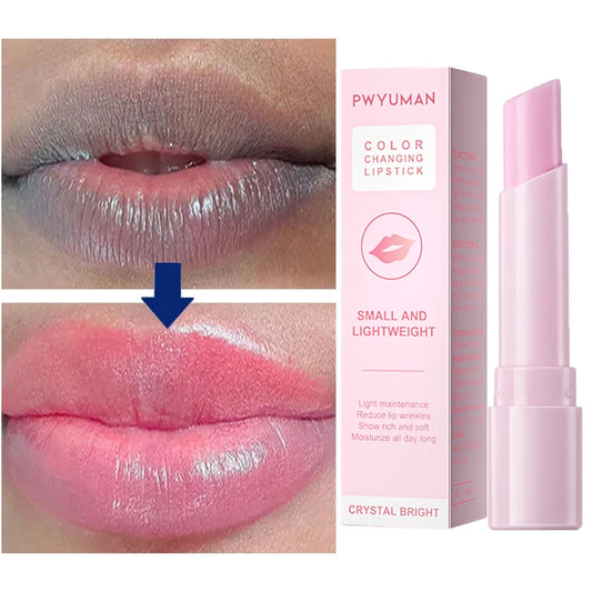 Lip Balm Remove Dark Spots Pigment Fast Lighten Pink Lips Cream