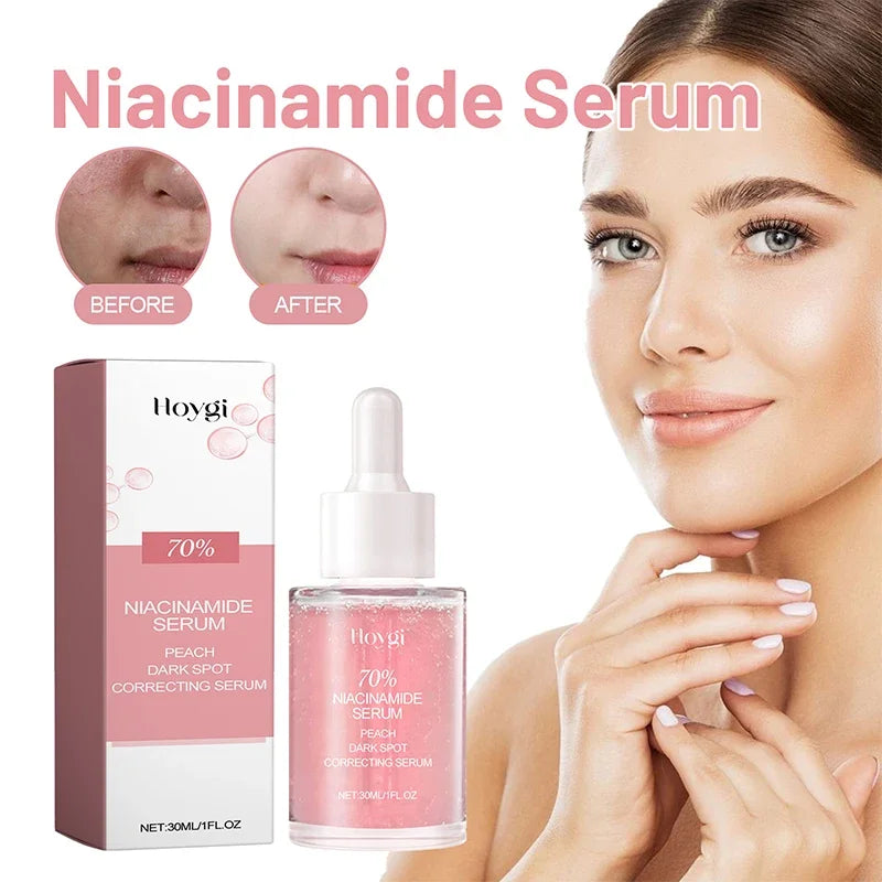 Korean Peach 70% Niacinamide Facial Serum,Face Brightening Hydrating Moisturizing Lotion,Skin Care Essence Fade Dullness Melasma