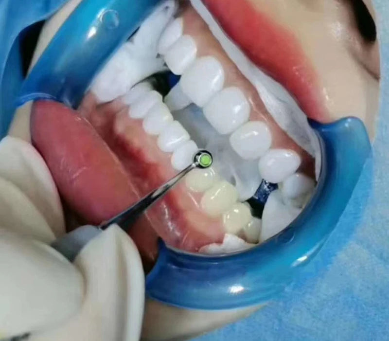 Dental Resin Filling Spatula Dental Molding Pad Anterior And Posterior Composite Resin Tool Foam Modeling Teeth Whitening Tool