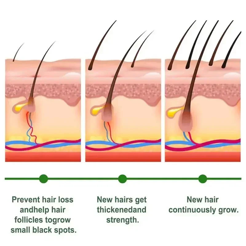 Hair Growth Essential Oil Rosemary Hair Serum Capsule Oil Anti Hair loss Baldness Repair Damaged Scalp Treatment For Women Men