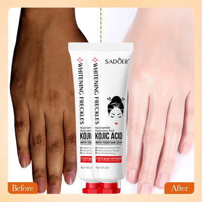 Kojic Acid Whiten Hand Cream,Moisturizing Nourishing Niacinamide Hyaluronic Acid Tender Hand Lotion,Foot Skin Care Products