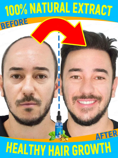 Use natural herbs to make your hair thicker thicker and stronger