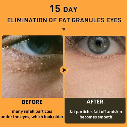 Fat Granules Removal Eye Cream Stick Anti-Puffiness Anti Inflammatory Eye Skin Care Reduce Dark Circles Repair Barrier Products
