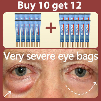 Daily eye cream, say goodbye to dark circles and eye troubles.