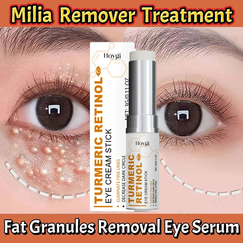 Fat Granules Removal Eye Cream Stick Anti-Puffiness Anti Inflammatory Eye Skin Care Reduce Dark Circles Repair Barrier Products