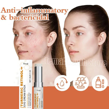 Fat Granules Removal Eye Cream Stick Anti-Puffiness Anti Inflammatory Eye Skin Care Reduce Dark Circles Repair Barrier Products