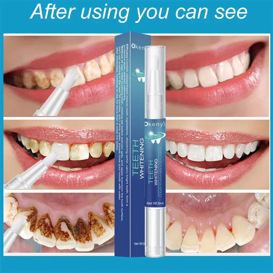 2.5ml Whiten Teeth Tooth Whitening Pen Gel Teeth Whitening Pen Cleaning Serum Remove Plaque Stains Oral Hygiene Dental Tool 1Box
