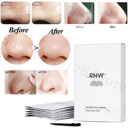 Nasal stickers to remove blackheads and shrink pores, deep cleansing warm and non-irritating nasal stickers