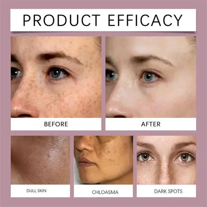 Fast Eliminates Melanin Pigmentation Melasma Dark Spots Skin Care New 2025