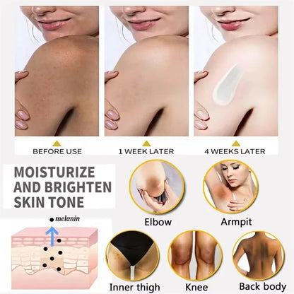 Whitening Cream Private Parts Underarm Bleaching Lotion Whiten Butt Knee Brighten Inner Thigh Intimate Parts Dark Remove Melanin