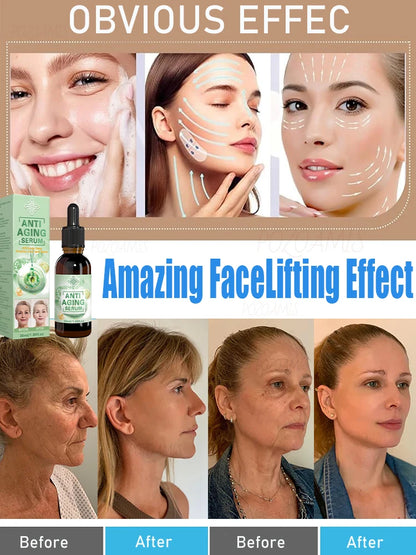 Wrinkles disappear, the first choice for beauty lovers