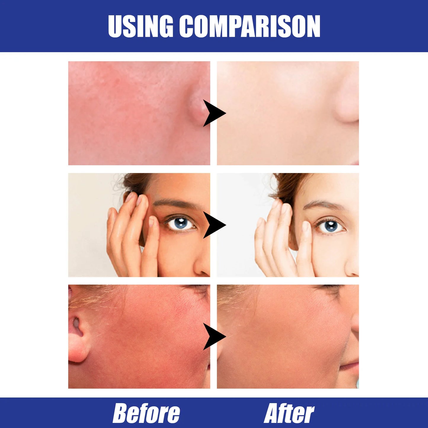 Sunscreen Stick UV Protective Cream Spf50 Gel Isolation Lotion Anti Oxidant Sunblock Waterproof Oil Control Whitening Sun Cream