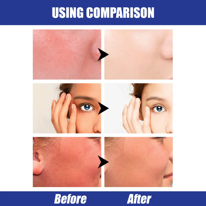 Sunscreen Stick UV Protective Cream Spf50 Gel Isolation Lotion Anti Oxidant Sunblock Waterproof Oil Control Whitening Sun Cream