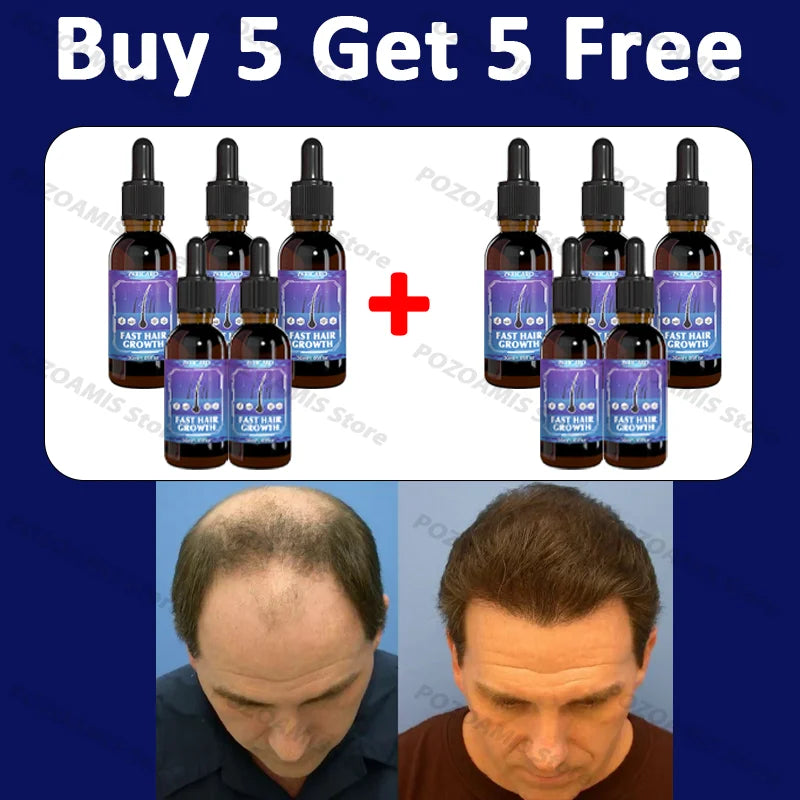 99% repurchase, more and more hair, say goodbye to baldness, hot selling product