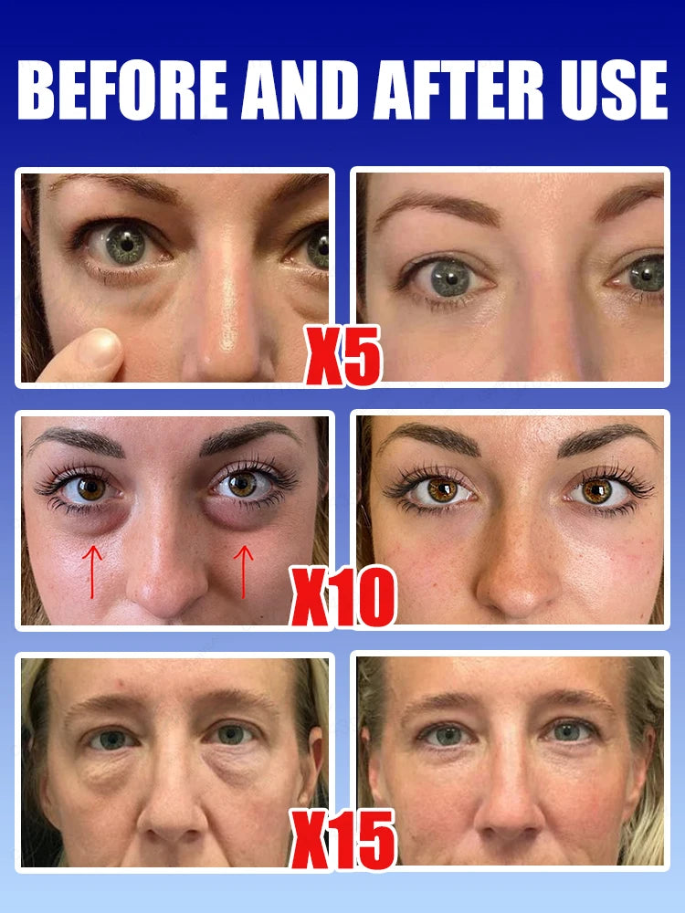 Daily eye cream, say goodbye to dark circles and eye troubles.